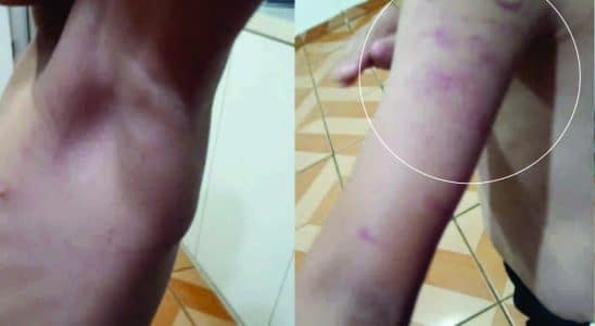 Criança Autista De 5 Anos É Agredido Por Funcionária De Escola Em Itapevi