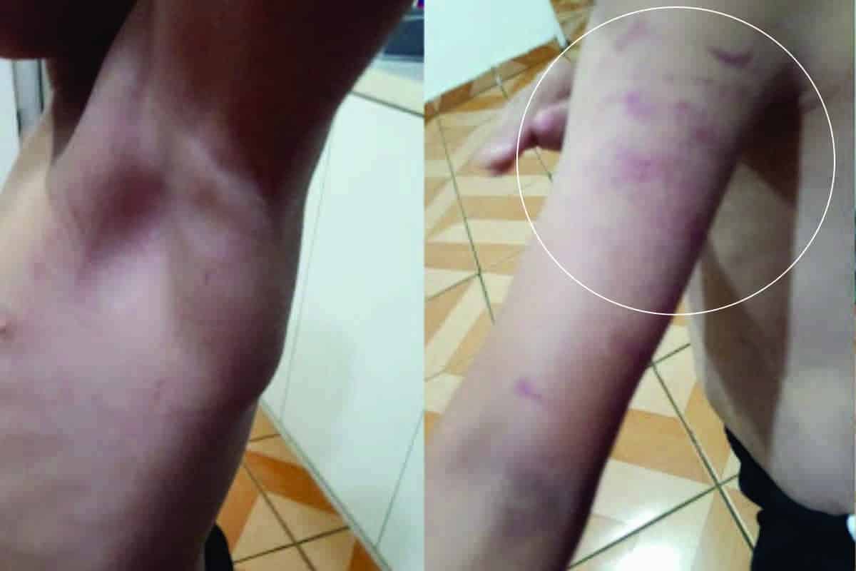 Criança Autista De 5 Anos É Agredido Por Funcionária De Escola Em Itapevi